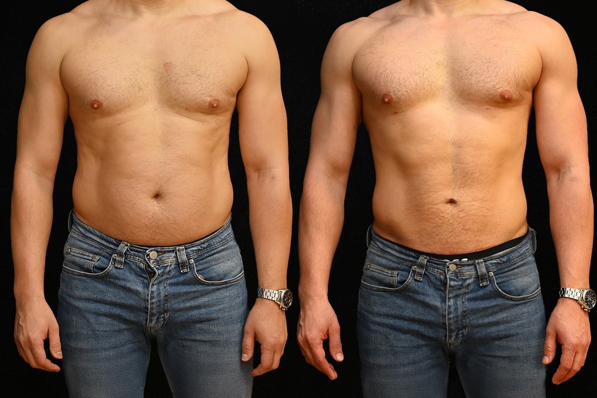 MOUSTAKIS ILIAS MD, MSc, FEBOPRAS: Φωτογραφίες & Βίντεο