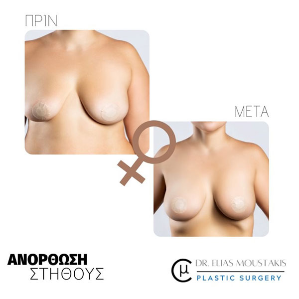 MOUSTAKIS ILIAS MD, MSc, FEBOPRAS: Φωτογραφίες & Βίντεο