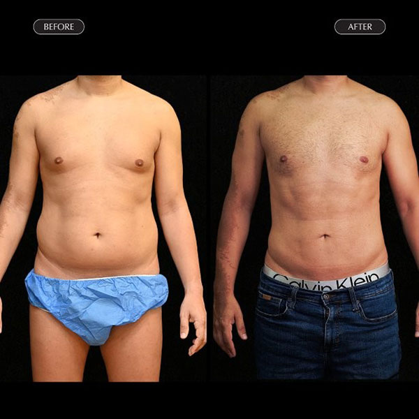 MOUSTAKIS ILIAS MD, MSc, FEBOPRAS: Φωτογραφίες & Βίντεο