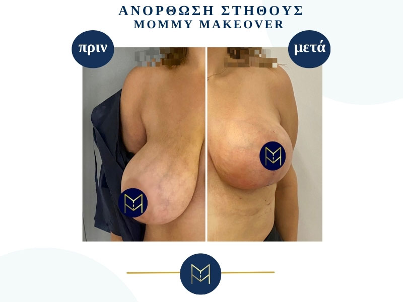 MOUSTAKI I. MARGARITA MD MSc PhD: Φωτογραφίες & Βίντεο