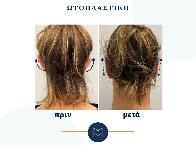 MOUSTAKI I. MARGARITA MD MSc PhD: Φωτογραφίες & Βίντεο