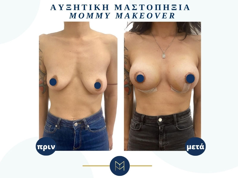 MOUSTAKI I. MARGARITA MD MSc PhD: Φωτογραφίες & Βίντεο