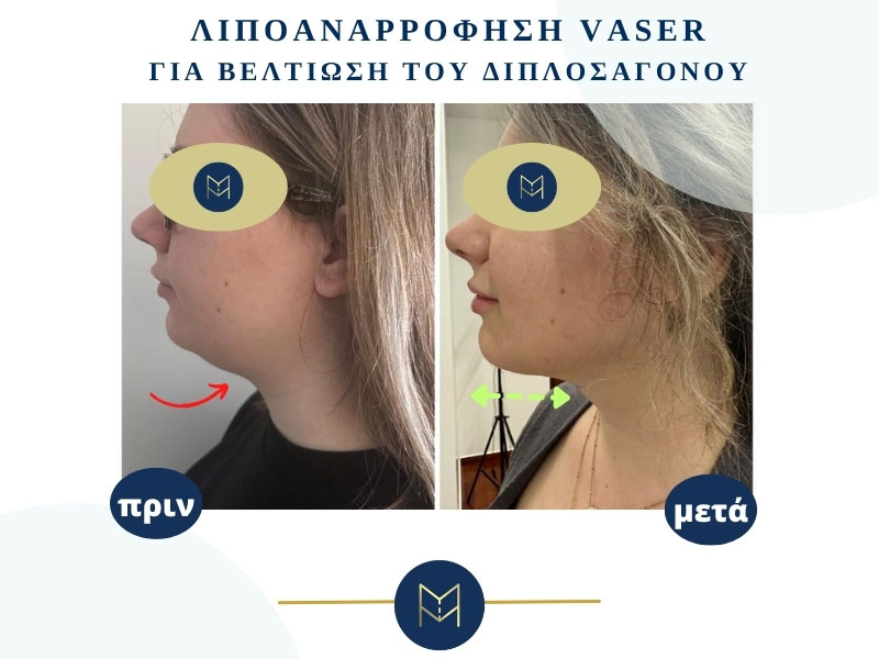 MOUSTAKI I. MARGARITA MD MSc PhD: Φωτογραφίες & Βίντεο