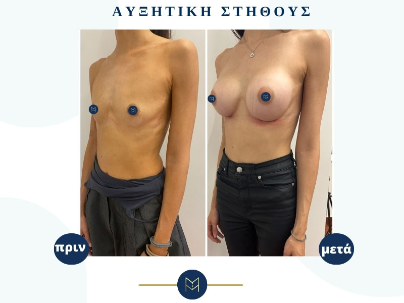 MOUSTAKI I. MARGARITA MD MSc PhD: Φωτογραφίες & Βίντεο