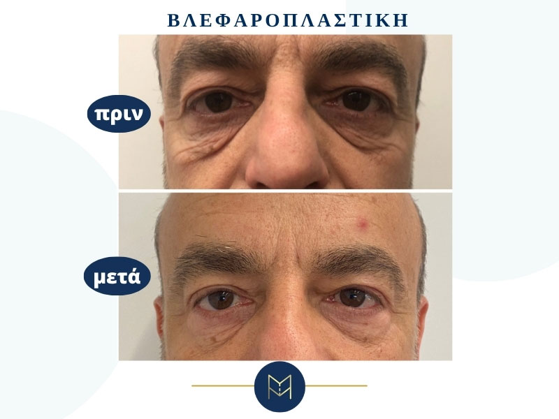 MOUSTAKI I. MARGARITA MD MSc PhD: Φωτογραφίες & Βίντεο