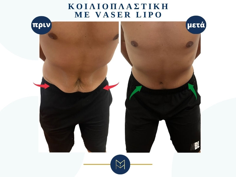 MOUSTAKI I. MARGARITA MD MSc PhD: Φωτογραφίες & Βίντεο