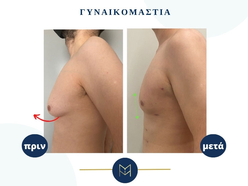 MOUSTAKI I. MARGARITA MD MSc PhD: Φωτογραφίες & Βίντεο