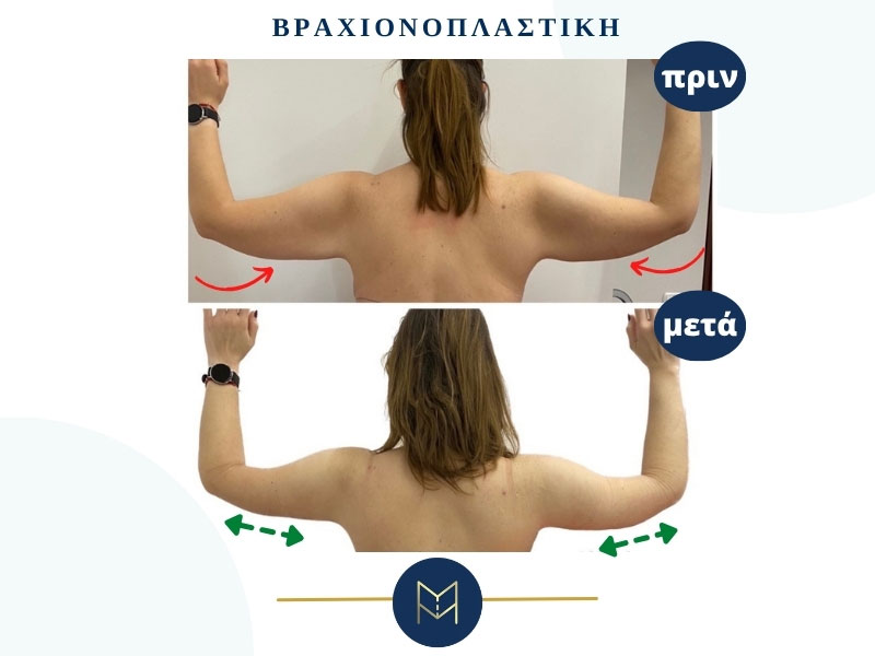 MOUSTAKI I. MARGARITA MD MSc PhD: Φωτογραφίες & Βίντεο