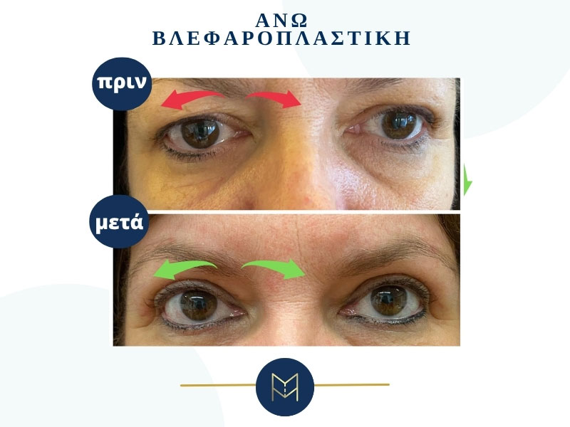 MOUSTAKI I. MARGARITA MD MSc PhD: Φωτογραφίες & Βίντεο