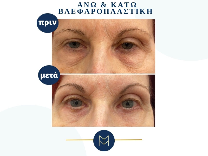 MOUSTAKI I. MARGARITA MD MSc PhD: Φωτογραφίες & Βίντεο
