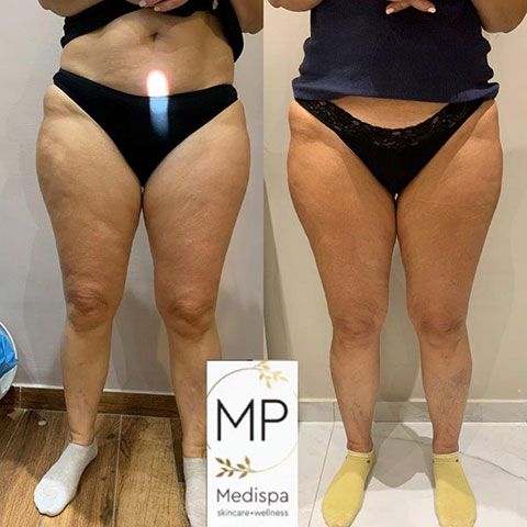 MP MEDISPA - ΠΑΠΑΔΗΜΑ ΜΑΡΙΑ: Φωτογραφίες & Βίντεο