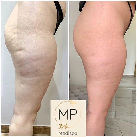 MP MEDISPA - ΠΑΠΑΔΗΜΑ ΜΑΡΙΑ: Φωτογραφίες & Βίντεο
