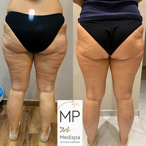 MP MEDISPA - ΠΑΠΑΔΗΜΑ ΜΑΡΙΑ: Φωτογραφίες & Βίντεο