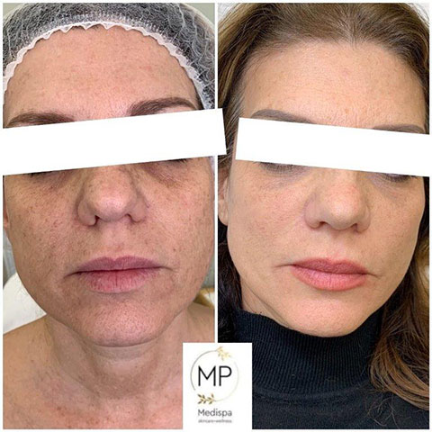 MP MEDISPA - ΠΑΠΑΔΗΜΑ ΜΑΡΙΑ: Φωτογραφίες & Βίντεο