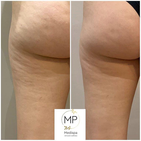 MP MEDISPA - ΠΑΠΑΔΗΜΑ ΜΑΡΙΑ: Φωτογραφίες & Βίντεο