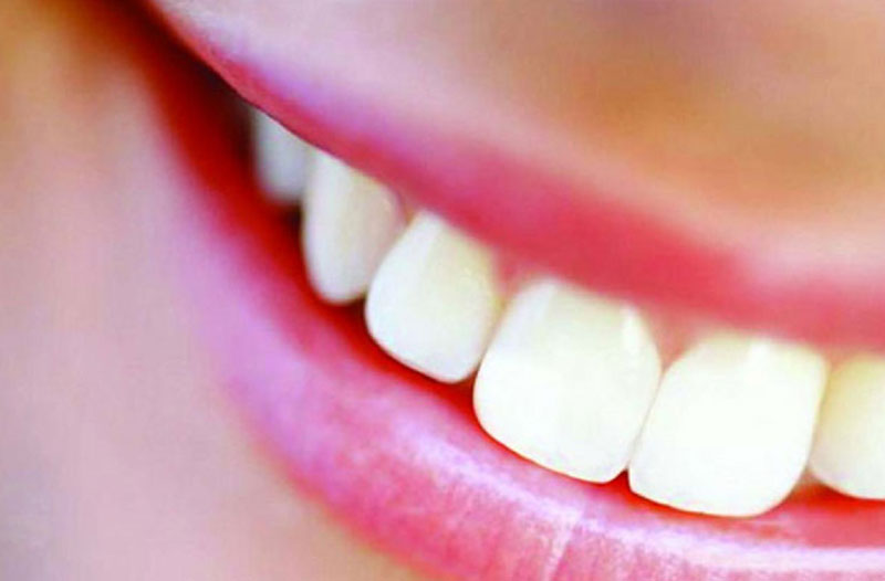 Tooth whitening