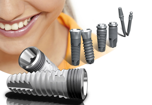 Titanium implants