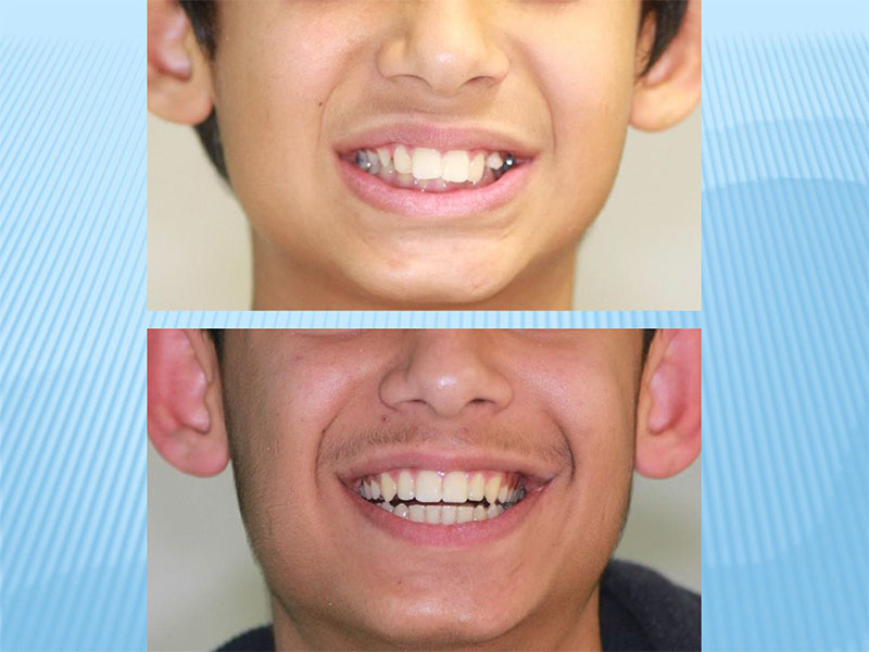 MY ORTHODONTISTS - KARAMITSOU EVAGGELINAKI ELEFTHERIA DDS, MSD - EVAGGELINAKIS NIKOLAOS DD: Φωτογραφίες & Βίντεο