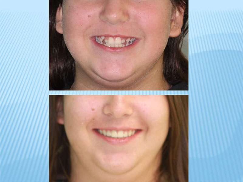 MY ORTHODONTISTS - KARAMITSOU EVAGGELINAKI ELEFTHERIA DDS, MSD - EVAGGELINAKIS NIKOLAOS DD: Φωτογραφίες & Βίντεο