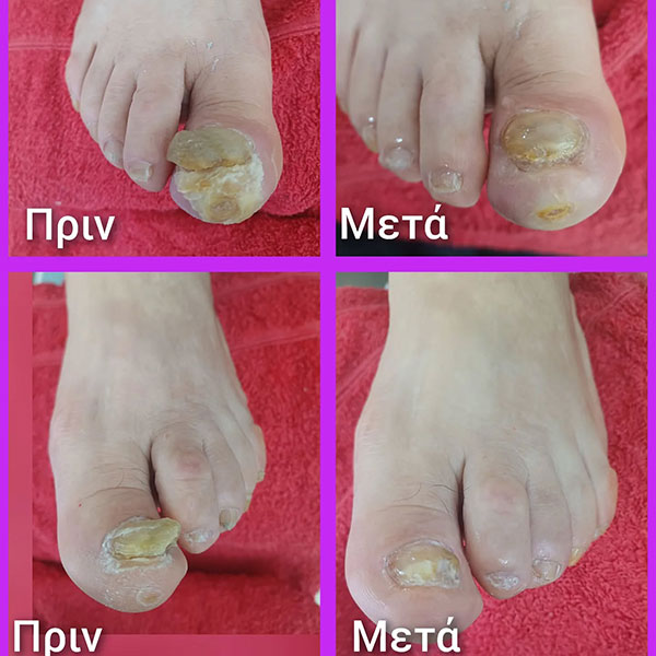 NERAIDA NAILS: Φωτογραφίες & Βίντεο