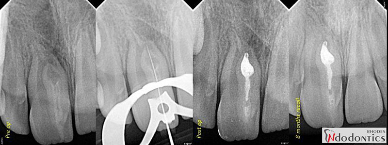 NIKOLIS M. PANAGIOTIS - RHODES ENDODONTICS: Φωτογραφίες & Βίντεο