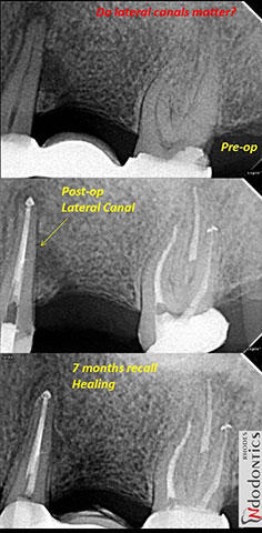 NIKOLIS M. PANAGIOTIS - RHODES ENDODONTICS: Φωτογραφίες & Βίντεο