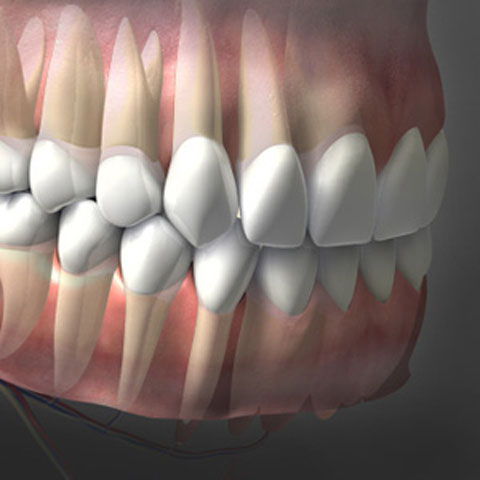 Periodontology