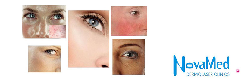 NOVAMED DERMOLASER CLINICS: Φωτογραφίες & Βίντεο