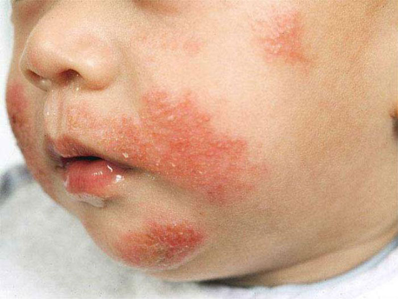 NOVAMED DERMOLASER CLINICS: Φωτογραφίες & Βίντεο