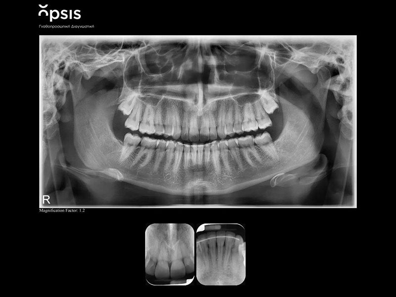 OPSIS - GNATHOPROSOPIKI DIAGNOSTIKI: Φωτογραφίες & Βίντεο