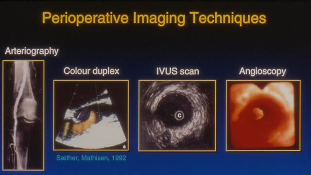 Imaging techniques