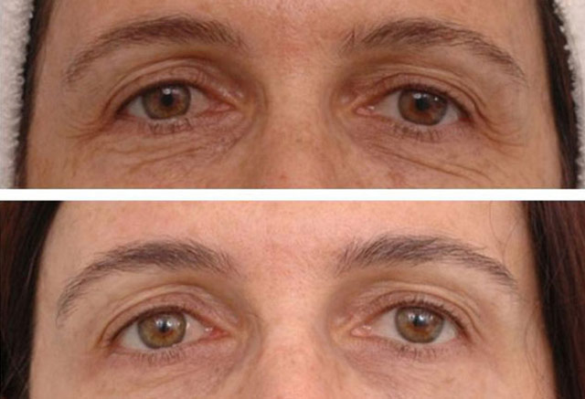Antiaging - Regeneration