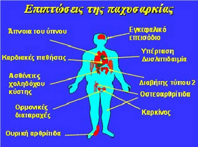 Θεραπεία παχυσαρκίας