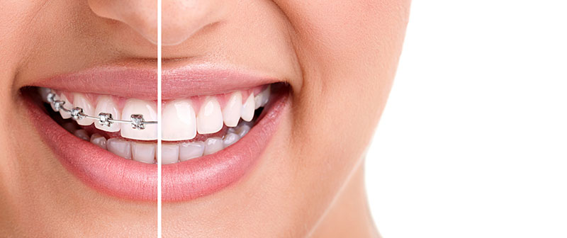 ΠΑΠΑΠΑΝΑΓΙΩΤΟΥ ΚΩΝΣΤΑΝΤΙΝΟΣ - SMILE LINE ELP: Φωτογραφίες & Βίντεο