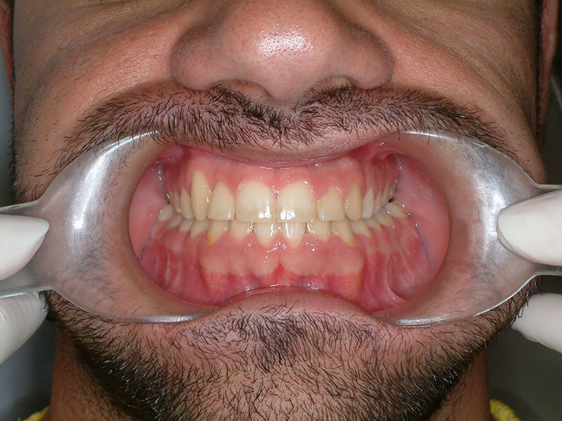 ΠΑΠΑΠΑΝΑΓΙΩΤΟΥ ΚΩΝΣΤΑΝΤΙΝΟΣ - SMILE LINE ELP: Φωτογραφίες & Βίντεο