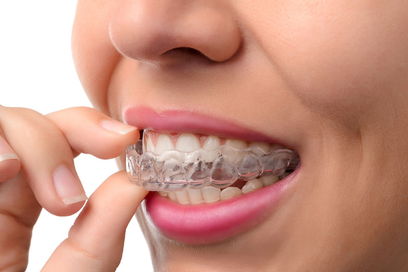 ΠΑΠΑΠΑΝΑΓΙΩΤΟΥ ΚΩΝΣΤΑΝΤΙΝΟΣ - SMILE LINE ELP: Φωτογραφίες & Βίντεο