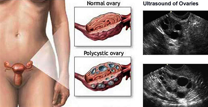 PASCHOU A. STAVROULA MD, PhD: Φωτογραφίες & Βίντεο