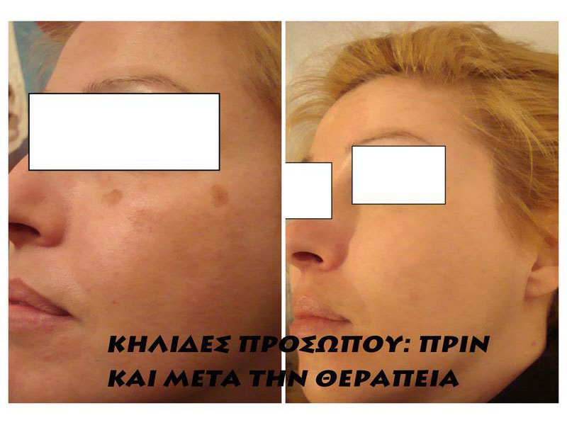 ΠΕΠΠΑΣ ΧΡΗΣΤΟΣ: Φωτογραφίες & Βίντεο