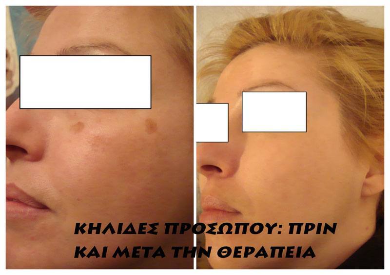 PEPPAS CHRISTOS: Φωτογραφίες & Βίντεο