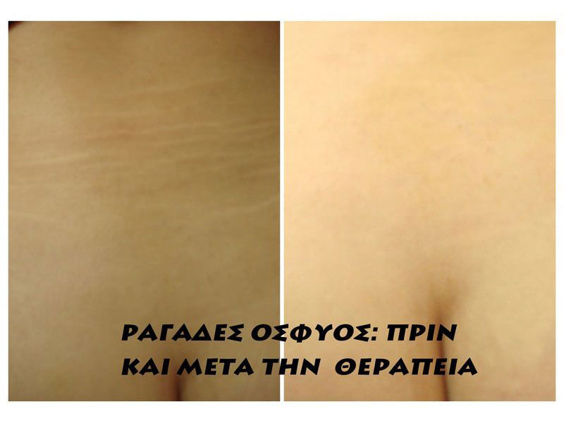 PEPPAS CHRISTOS: Φωτογραφίες & Βίντεο