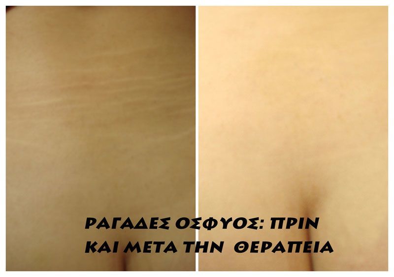 PEPPAS CHRISTOS: Φωτογραφίες & Βίντεο