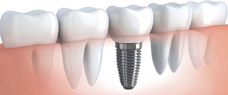 PERIODONTAL CARE - BALAFOUTI SOFIA V.: Φωτογραφίες & Βίντεο