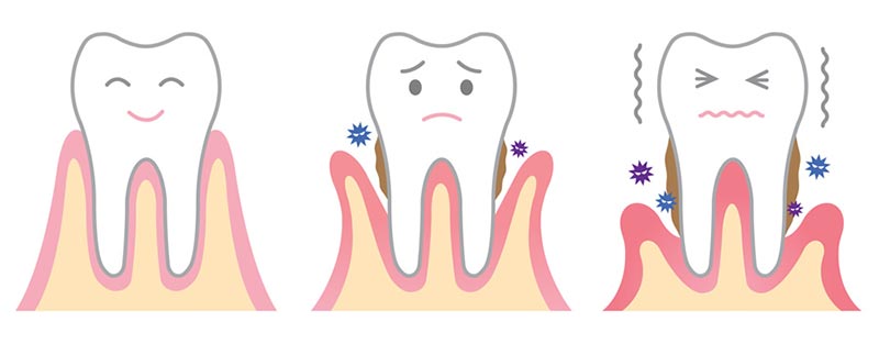 PERIODONTAL CARE - BALAFOUTI SOFIA V.: Φωτογραφίες & Βίντεο