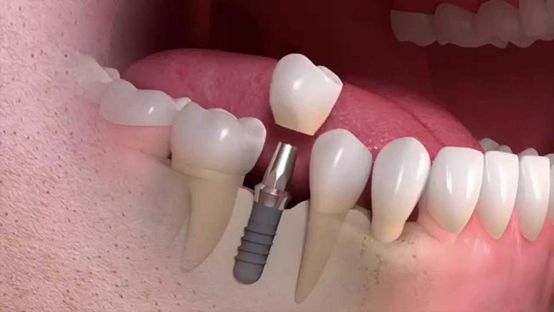 PERIODONTAL CARE - BALAFOUTI SOFIA V.: Φωτογραφίες & Βίντεο