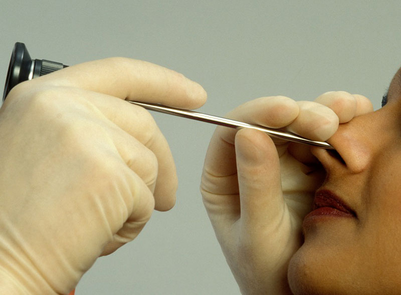 Clinical Examination - Endoscopy of the Nose