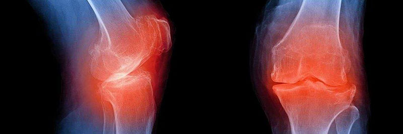 PHYSIODANALI: Φωτογραφίες & Βίντεο