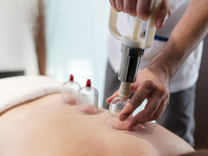 Cupping Therapy - Physiopolis