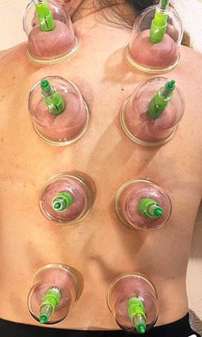 PHYSIOTONOSIS: Φωτογραφίες & Βίντεο