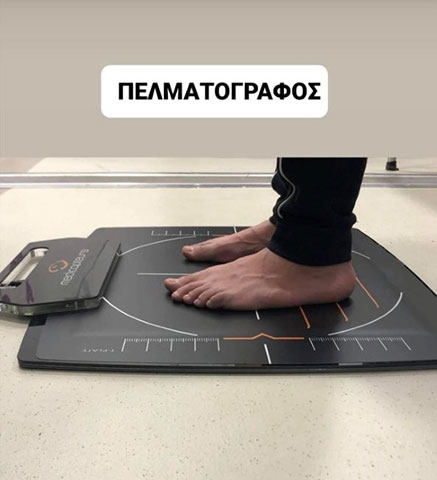 Πελματογράφημα