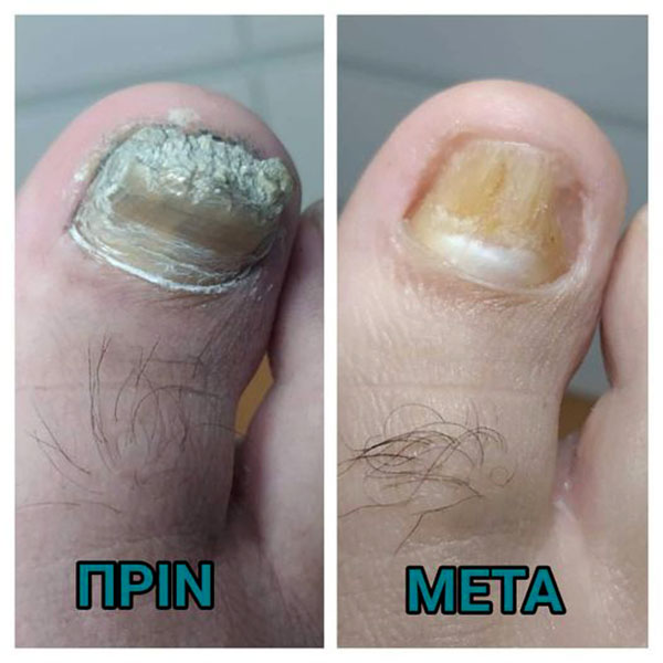 ΠΟΔΟΛΟΓΙΚΟ ΚΕΝΤΡΟ ΣΤΑΜΑΤΟΓΙΑΝΝΗ ΚΩΝΣΤΑΝΤΙΝΑ: Φωτογραφίες & Βίντεο